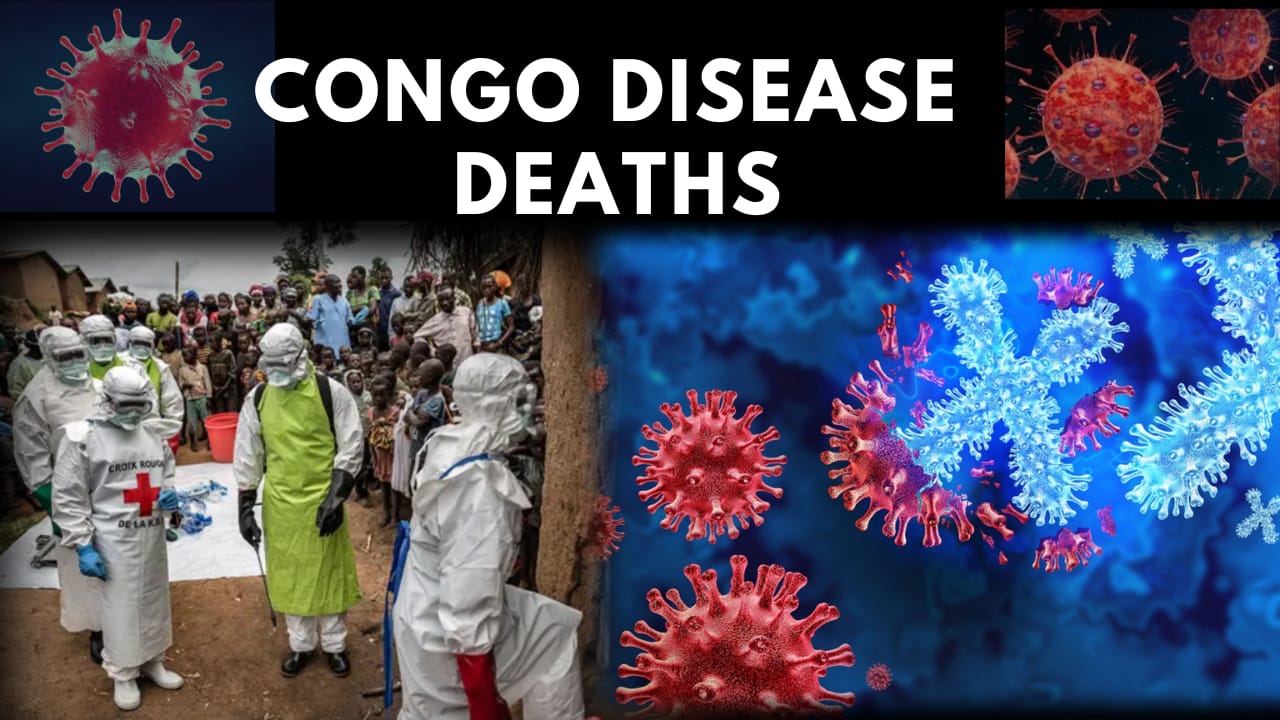 Mystery Disease in Congo 2025